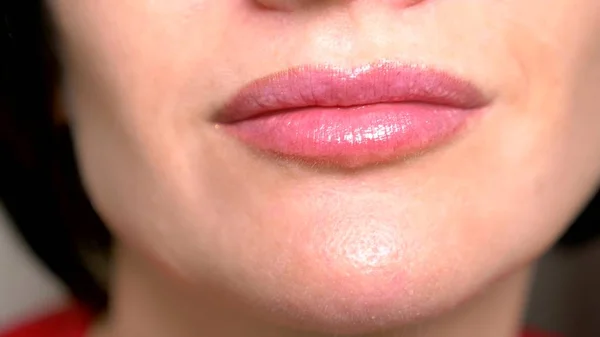 Súper cerca. labios femeninos con brillo labial, sonrisa. enfermedad dermatológica de los labios mucosos, gránulos de Fordyce — Foto de Stock