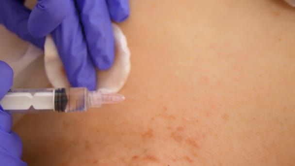 Die Kosmetikerin macht Injektionen, Anti-Aging-Verfahren zur Straffung und Glättung von Falten auf der Haut der Brust und des Halses einer Frau. — Stockvideo