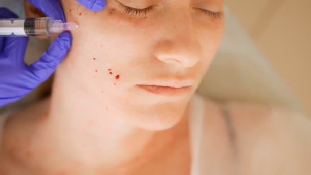 El esteticista hace inyecciones, procedimientos antienvejecimiento para apretar y alisar las arrugas en la piel del pecho y el cuello de una mujer . — Vídeos de Stock