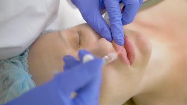 Lip injectie, operatie om het volume van de lippen te verhogen. Doctor schoonheidsspecialist maakt contouren plastic om de lippen te verhogen — Stockvideo