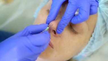 Kozmetoloji kavramı. Burun kontur düzeltmesi. Doktor kozmetolojist, hastaların kadının burnuna bir dolgu maddesi enjekte ediyor. Close