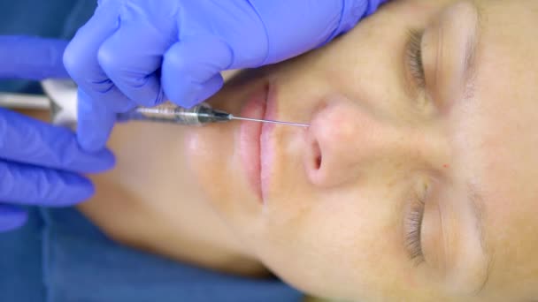 美容学概念。鼻子轮廓校正。医生的美感师在病人鼻子里注射了填充物。特写 — 图库视频影像