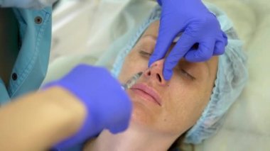 Kozmetoloji kavramı. Burun kontur düzeltmesi. Doktor kozmetolojist, hastaların kadının burnuna bir dolgu maddesi enjekte ediyor. Close