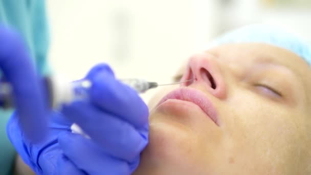 Concepto de cosmetología. Corrección de contorno nasal. El médico cosmetólogo inyecta un relleno en la nariz de la mujer paciente. primer plano — Vídeo de stock