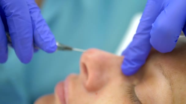 Η ιδέα της κοσμετολογίας. Διόρθωση περιγράμματος μύτης. Ο γιατρός αισθητικός εισάγει ένα πληρωτικό στη μύτη της γυναίκας των ασθενών. Γκρο πλαν — Αρχείο Βίντεο