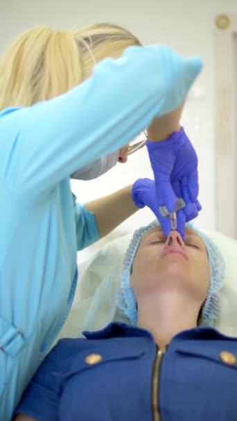 Video verticale. Concetto di cosmetologia. Correzione del profilo del naso. Medico cosmetologo inietta un riempitivo nel naso della donna pazienti. primo piano — Video Stock