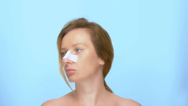 Le concept de chirurgie plastique. portrait de rhinoplastie d'une femme avec un bandage sur le nez après la procédure de rhinoplastie. sur fond bleu — Photo