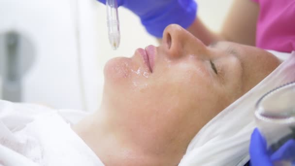 Concepto de cosmetología, cuidado facial. cara de mujer durante el procedimiento de descamación por chorro, facial — Vídeos de Stock