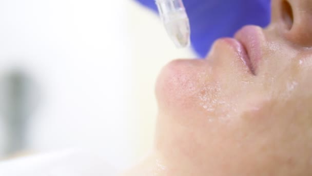 Concepto de cosmetología, cuidado facial. cara de mujer durante el procedimiento de descamación por chorro, facial — Vídeo de stock