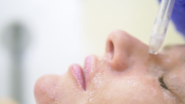 Concept de cosmétologie, soin du visage. visage de femme pendant la procédure d'épluchage de jet, visage — Video