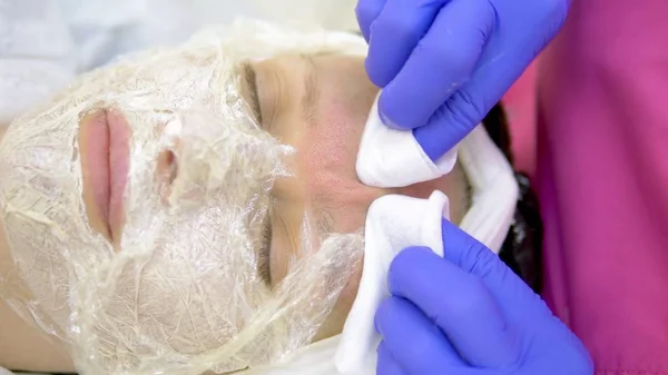 Close-up. face of a woman at a beautician appointment. Manual facial cleansing. Cleansing facial skin, beautician squeezed blackheads. — Stock Photo, Image