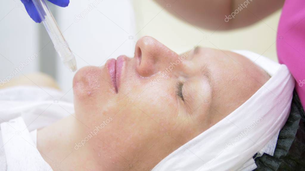 cosmetology concept, face care. woman face during the procedure of jet peeling, facial