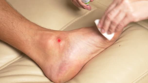 Close-up. tratamento de feridas com pomada anti-inflamatória. Primeiros socorros para abrasões — Vídeo de Stock