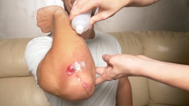 Close-up. treatment of wounds with hydrogen peroxide. first aid for abrasions. — Stock Video