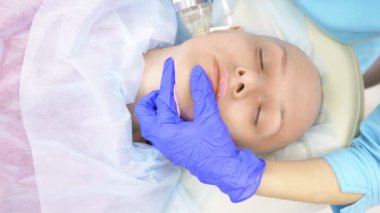 Close. microneedle Rf kaldırma işlemi. Donanım kozmetolojisi. Güzellik uzmanı kel bir kadın için yüz gençleştirme prosedürü uygular..