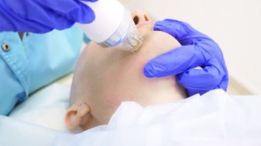 Close. microneedle Rf kaldırma işlemi. Donanım kozmetolojisi. Güzellik uzmanı kel bir kadın için yüz gençleştirme prosedürü uygular..