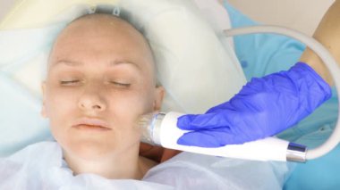 Close. microneedle Rf kaldırma işlemi. Donanım kozmetolojisi. Güzellik uzmanı kel bir kadın için yüz gençleştirme prosedürü uygular..