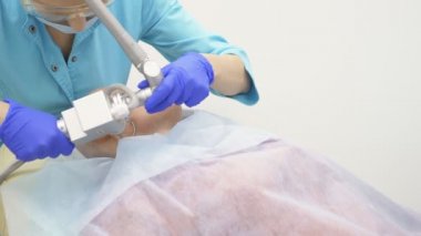 Doktor kozmetik uzmanı, yüzün lazerle yeniden yüzleştirilme prosedürünü uyguluyor. Cilt gençleştirme konsepti, donanım kozmetolojisi.
