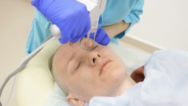 Dokter kosmetologis melakukan prosedur laser muncul kembali wajah. konsep peremajaan kulit, perangkat keras kosmetologi . — Stok Video