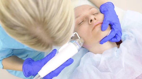Procedura podnoszenia RF mikroneedle. Kosmetyka sprzętowa. Kosmetyczka prowadzi zabieg odmodowania twarzy dla łysy kobiety. — Zdjęcie stockowe