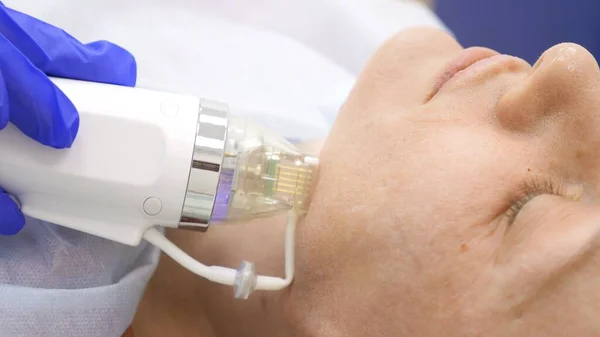 Close-up. microneedle RF lifting procedure. Hardware cosmetology. Beautician conducts a facial rejuvenation procedure for a bald woman. — Stock Photo, Image