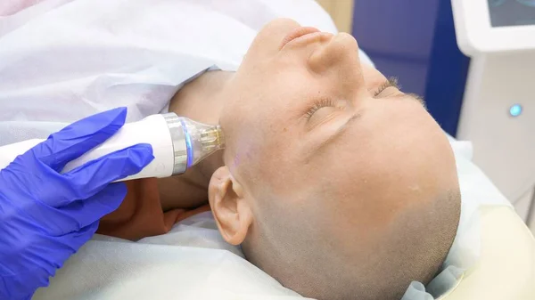 Närbild. Microneedle RF-lyft förfarande. Hårdvara kosmetika. Kosmetolog genomför en ansikts föryngring förfarande för en skallig kvinna. — Stockfoto