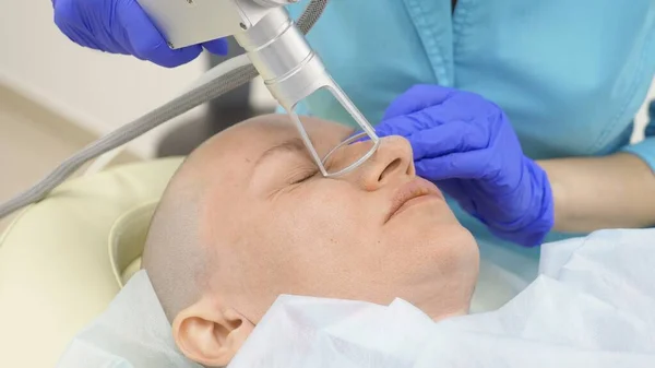 Dokter Cosmetoloog doet de procedure van laser opduiken van het gezicht. huidverjonging concept, hardware cosmetologie. — Stockfoto