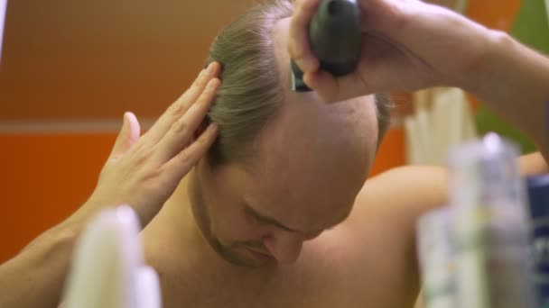 Hemma rakar en man sin skalliga fläck framför en spegel. håravfall problem — Stockvideo