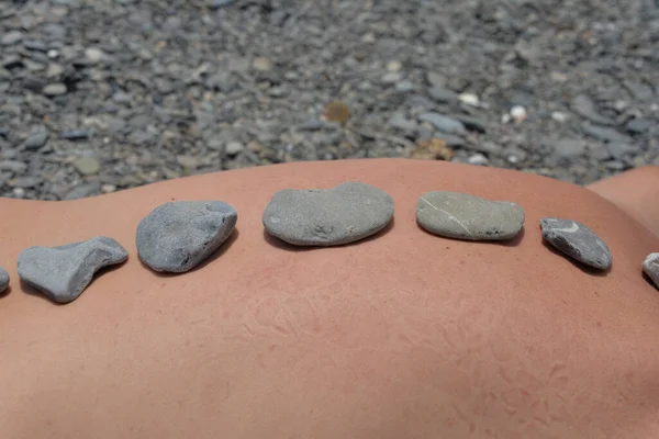 Joven Está Tirado Playa Hay Piedras Masaje Espalda —  Fotos de Stock