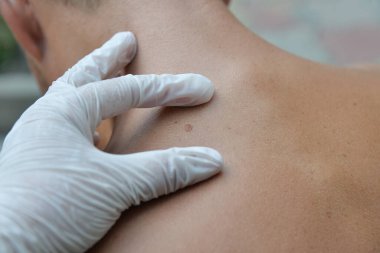 Deri hastalıkları tahriş, kaşıntı, çatlak yaralar acı verici hislere yol açar. Deride papillomlar, siğiller, benler, beyaz ve koyu benekler oluşabilir..