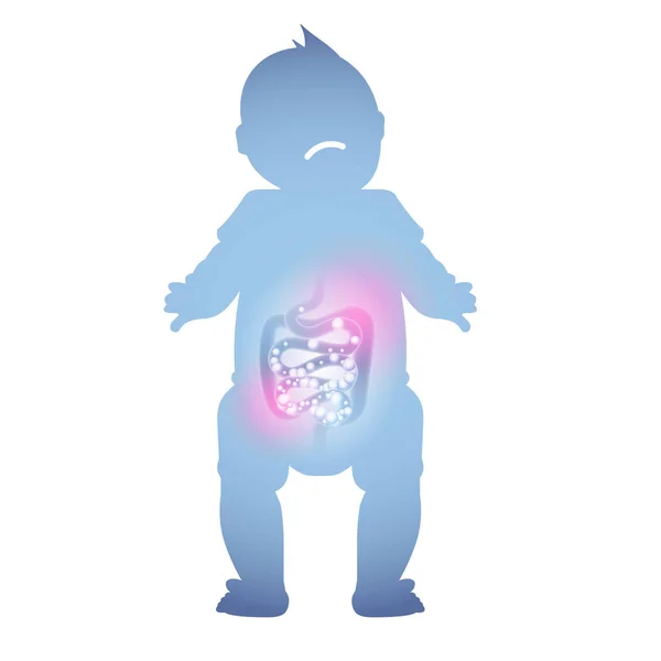 Абстрактная Иллюстрация Больного Детского Кишечника Больное Пищеварение Ребенка — стоковый вектор