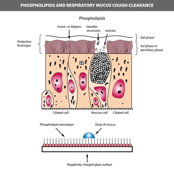 Medizinische Vektor Illustration Von Phospholipiden Und Atemwegshusten Kiliierte Und Schleimige — Stockvektor