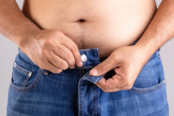 Cerrar Hombre Gordo Tratando Abotonar Pantalones Estudio Disparo Sobre Fondo — Foto de Stock