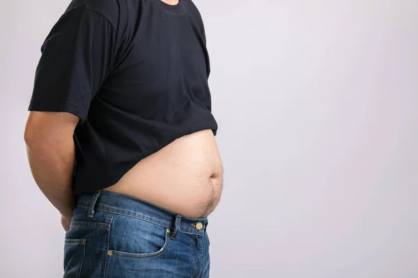 Concepto Chequeo Médico Gente Gorda Mostrando Gran Barriga Utilizado Para —  Fotos de Stock