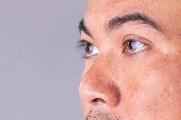 アジア人の男性のマクロフェイスの皮膚は多くの皮膚の問題を表示します 男性のスキンケアコンセプト上の灰色の空間背景 — ストック写真