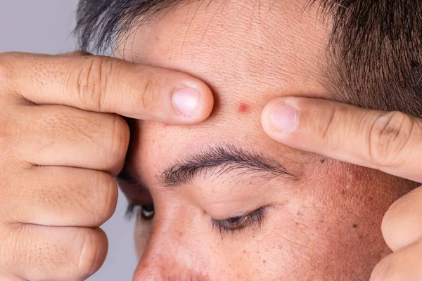 Macro face skin of asian man to show many skin problem. Men skin care concept on grey space background