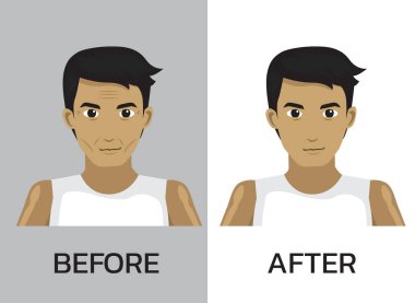 Yüz Yüzünden Önce Botoks Manga Adam Çizgi Filmi Vektör İllüstrasyonu