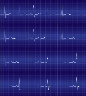 Animasyon Çerçevesi Kalp Hızı Ekran Vektörü İllüstrasyonu