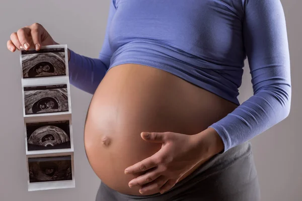 灰色の背景に彼女の赤ちゃんの超音波を保持している妊娠中の女性の画像 — ストック写真