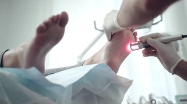 Modern bilim tıp merkezinde lazer atım teknolojisiyle ayak tedavisi. Koruyucu eldivenli ortopedist. Lazer ekipmanı kullanıyor ve hastaların ayaklarına ve parmaklarının altına dokunuyor.