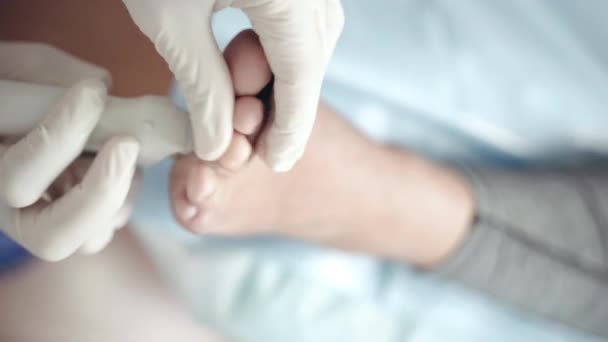 Spesialis ortopedi dalam sarung tangan steril putih menggunakan peralatan pulsasi lazer untuk terapi intensif penyakit kaki datar. Dokter Podiatric memeriksa pasien dan memegang prosedur pengobatan di medis — Stok Video