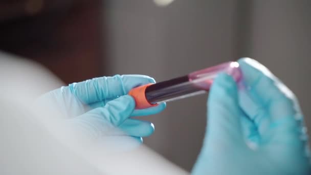 Tubo per esami del sangue con risultato positivo covid-19 nelle mani dei medici, primo piano delle mani del microbiologo nei guanti protettivi che tengono il tubo sanguigno della persona infetta da coronavirus. Ricerche di laboratorio e — Video Stock