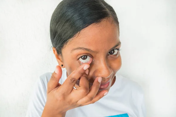 Contact Lens For Vision. Closeup Of Female Eye With Applying Contact Lens On Her Eyes. Beautiful Woman Putting Eye Lenses With Hands. Ophthalmology Medicine And Health