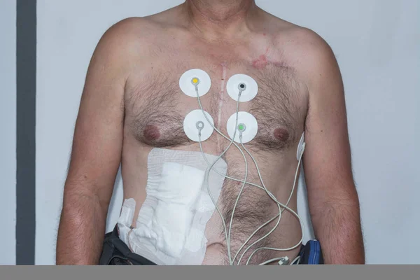 Nackter Oberkörper Eines Mannes Mit Elektroden Zur Messung Der Herzdruckkurve — Stockfoto