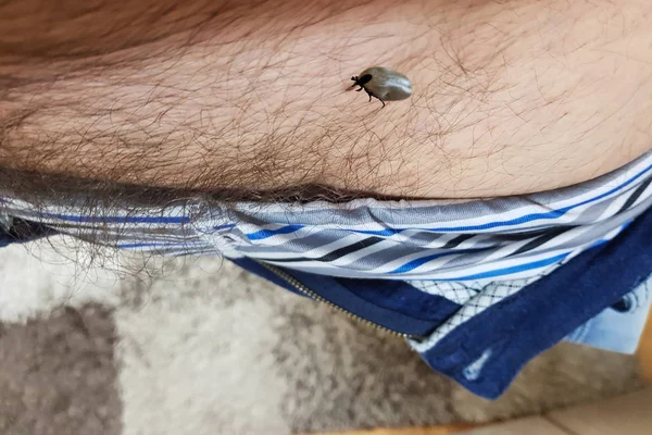 Tick, Ixodes ricinus on human skin in the genital area. Walking over the human body. Encephalitis tick, this type of animal is a spreader of Borrelia and Tbe. — Stock Image Tick Ixodes Ricinus Human Skin Genital Area Walking Human Body Stock Image