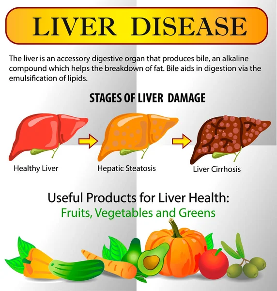 Infográficos Doença Hepática Alimentos Saudáveis Fígado Conceito Saudável Com Medicina —  Vetores de Stock