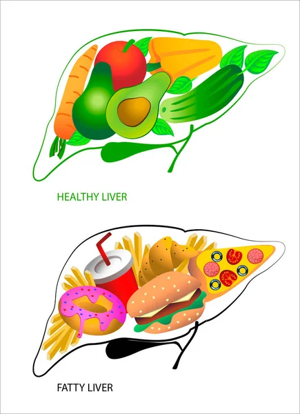 Cibo Sano Malsano Forma Fegato Concetto Consapevolezza Epatica Grassa Illustrazione — Vettoriale Stock