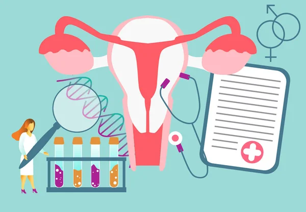 Malí Lékaři Vyšetřují Dělohu Lupou Léčbě Endometriózy Endometrióza Dysfunkce Endometria — Stockový vektor
