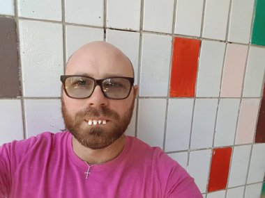 Gözlük çirkin dişleri olan kel adam