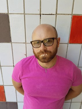 Gözlük çirkin dişleri olan kel adam